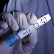 HIV test showing positive result